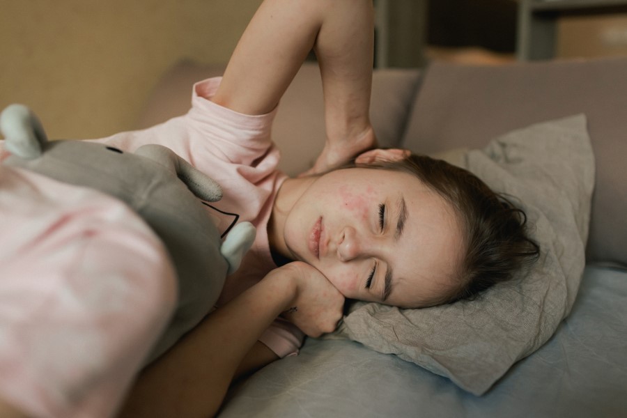 young girl with measles lying in a bed with eyes closed